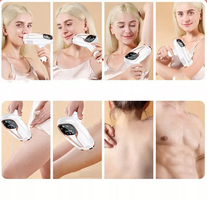 BLOW IPL lazerinis epiliatorius kūno, bikini ir kojų plaukų šalinimui